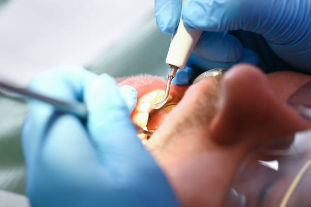 Best Urgent Tooth Repair  in Stanford, CA